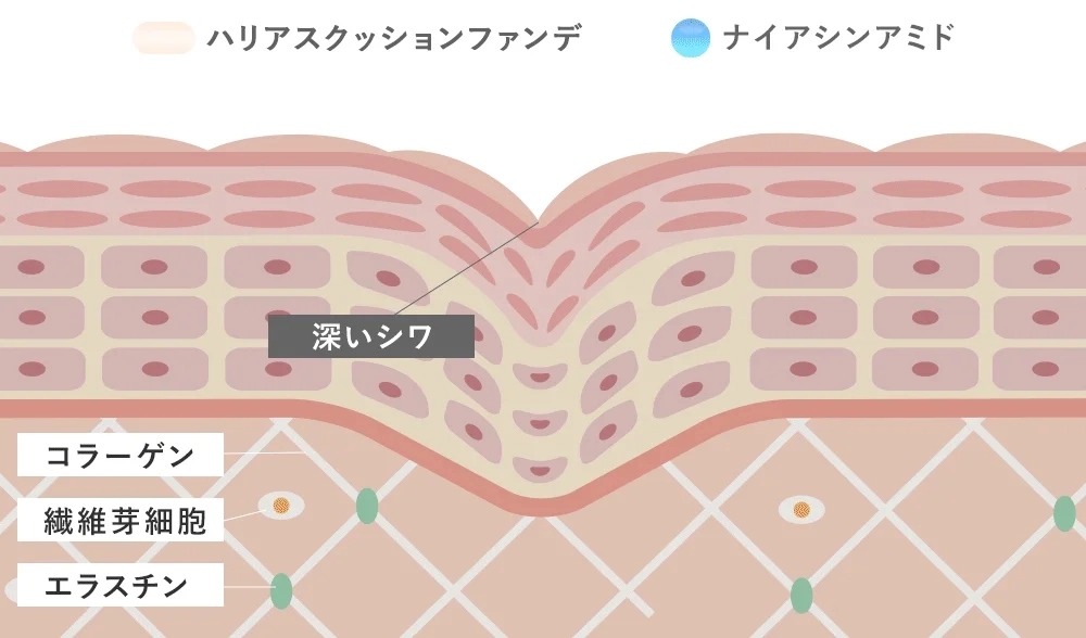Illustration of Skin Structure with Wrinkles and Niacinamide
