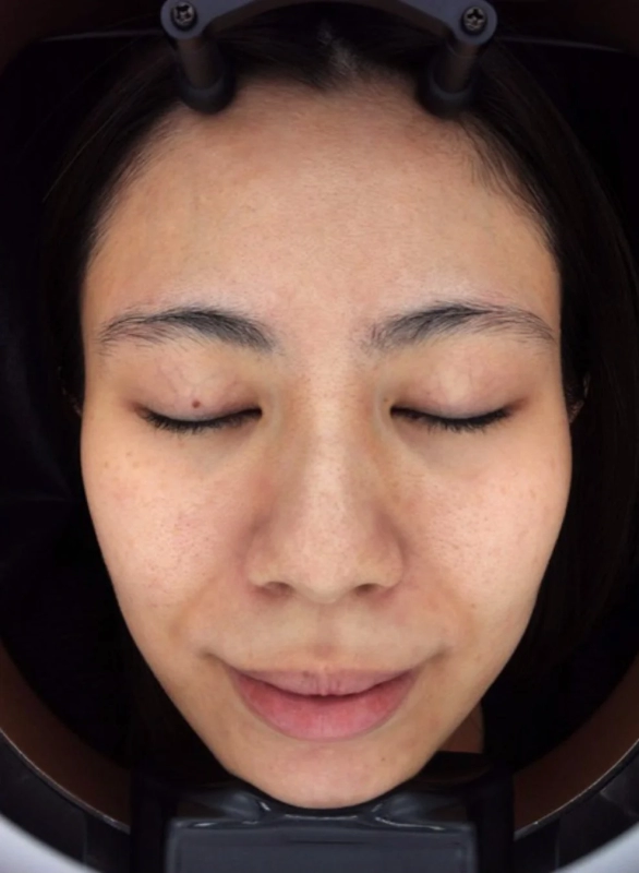 Staff H's Skin After