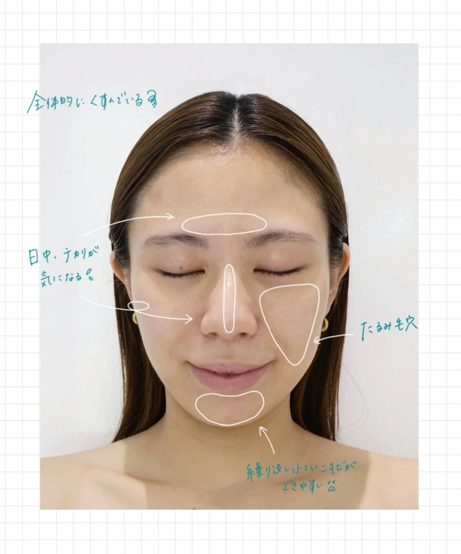 Staff H's Skin Before