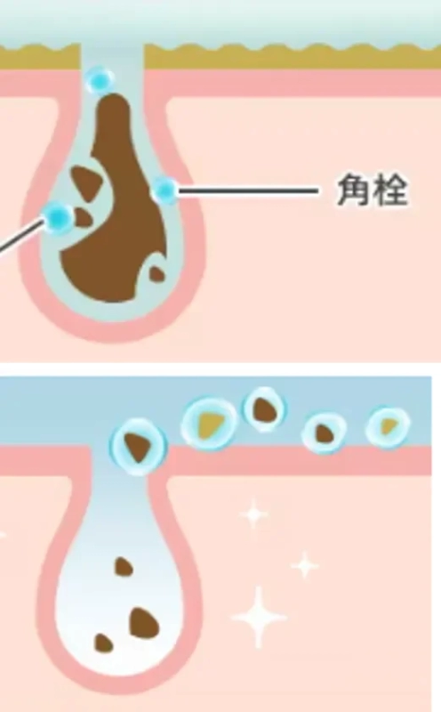 Pore Cleansing Illustration