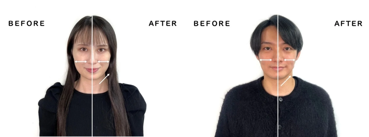 Before and After facial comparison